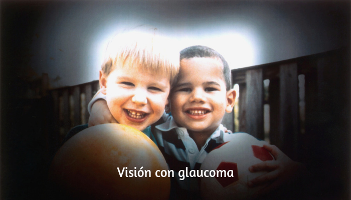 Medimos gratis la tensión Ocular - Campaña Prevención Glaucoma